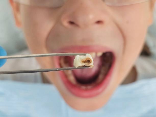 Best Pediatric Emergency Dentist in Newport, WA